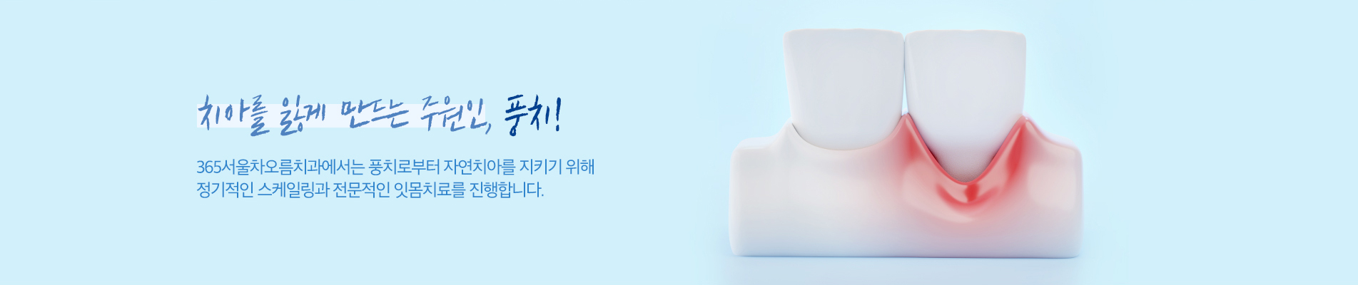 치아를 잃게 만드는 주원인, 풍치!